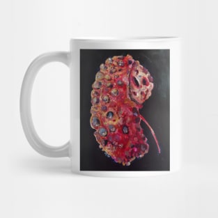 kidney disease Mug